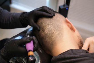 MicroInk SMP Hair Tattoo Shanghai